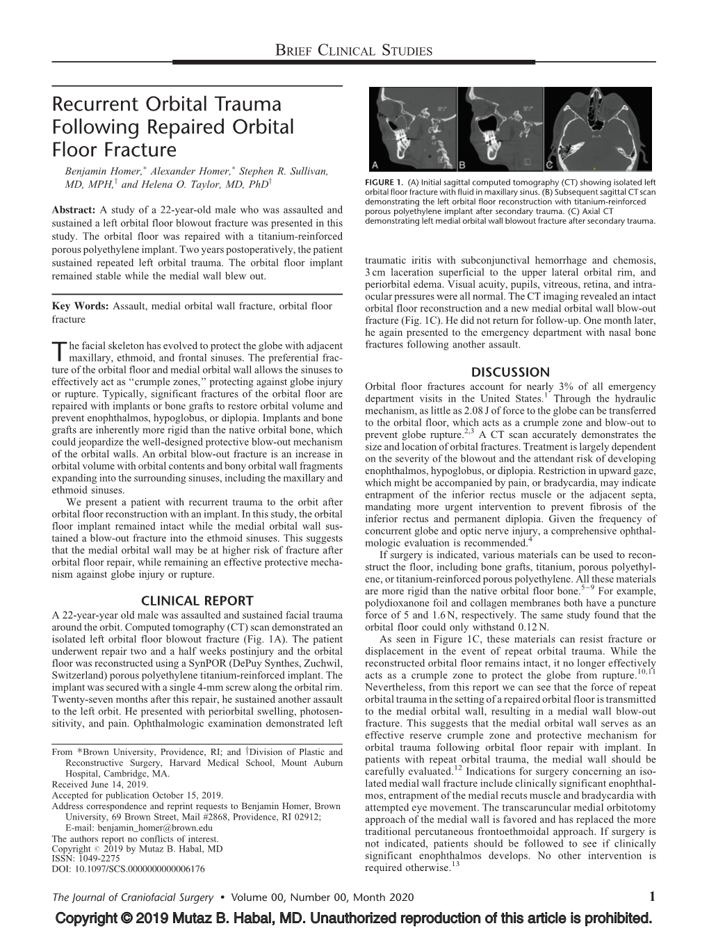 Recurrent Orbital Trauma Following Repaired Orbital Floor Fracture Benjamin Homer,� Alexander Homer,� Stephen R