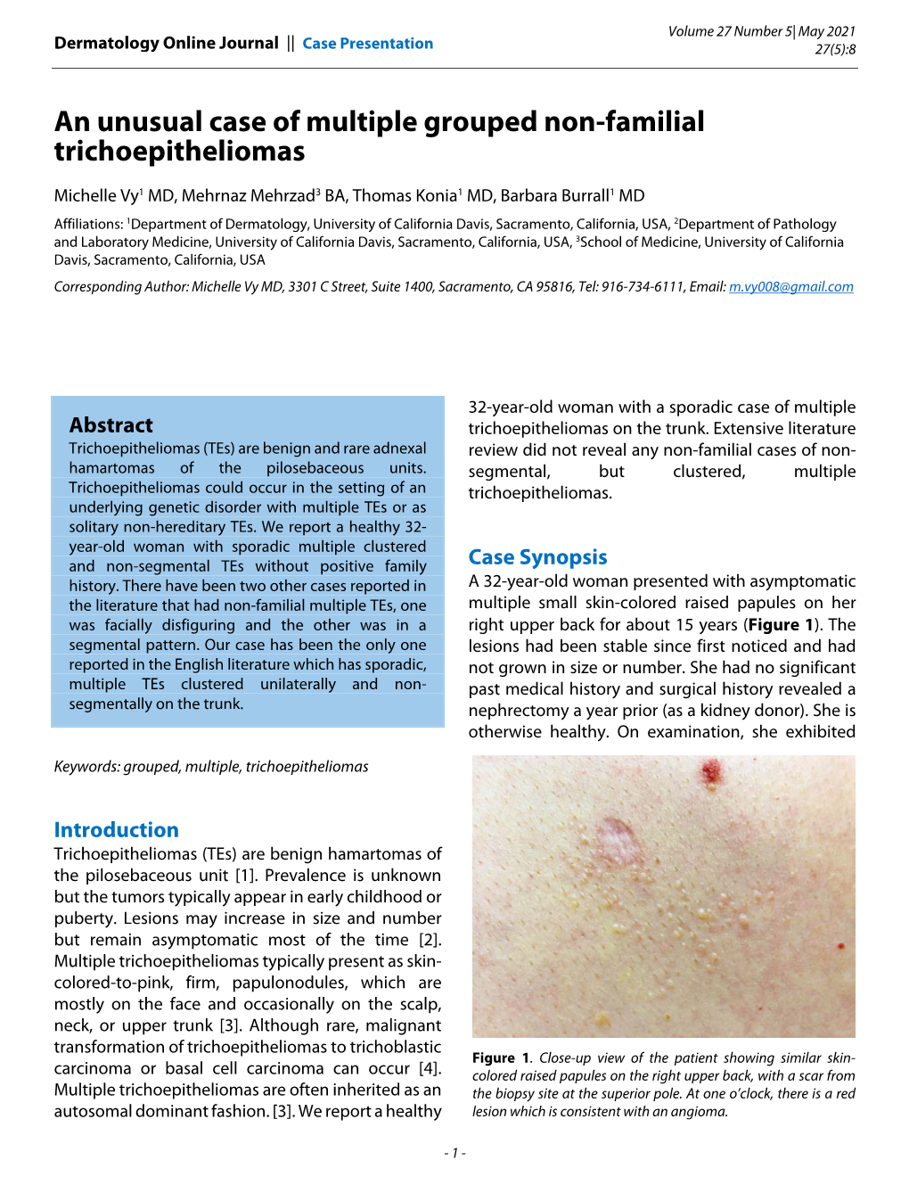 An Unusual Case of Multiple Grouped Non-Familial Trichoepitheliomas