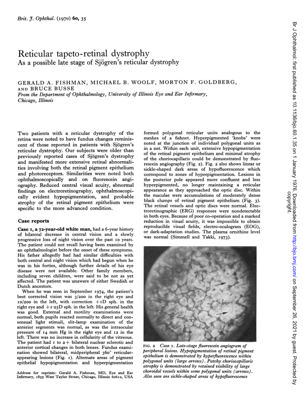 Reticular Tapeto-Retinal Dystrophy As a Possible Late Stage of Sjogren's Reticular Dystrophy