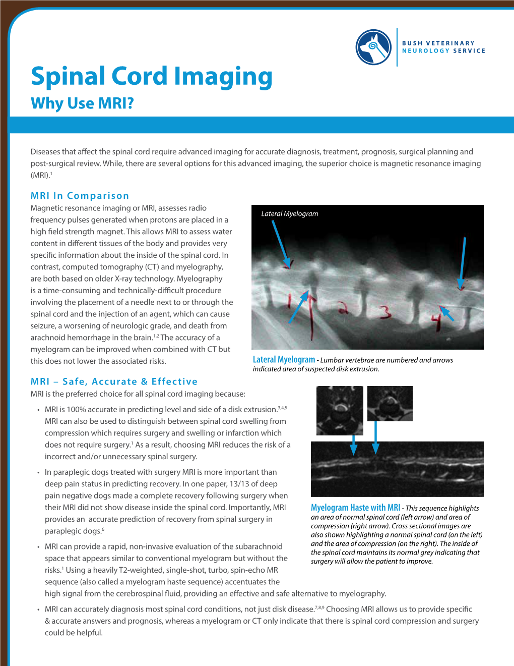 Spinal Cord Imaging Why Use MRI?