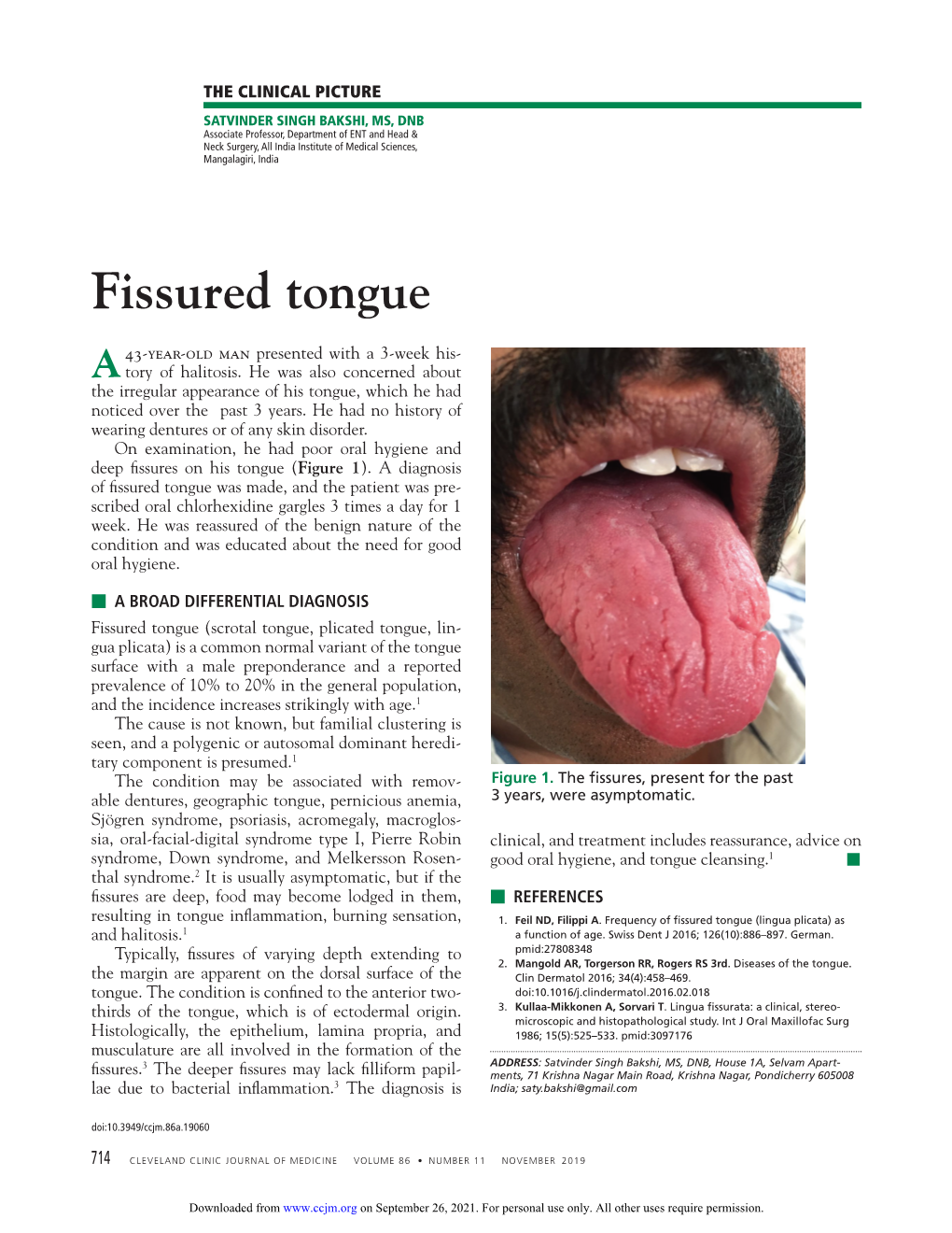 Fissured Tongue