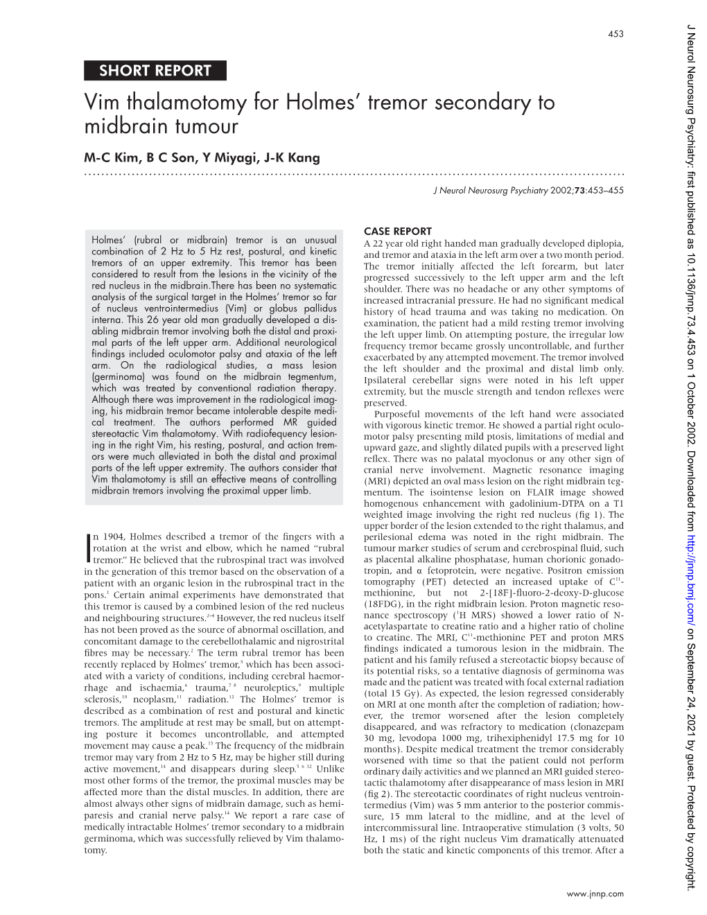 Vim Thalamotomy for Holmes' Tremor Secondary to Midbrain Tumour