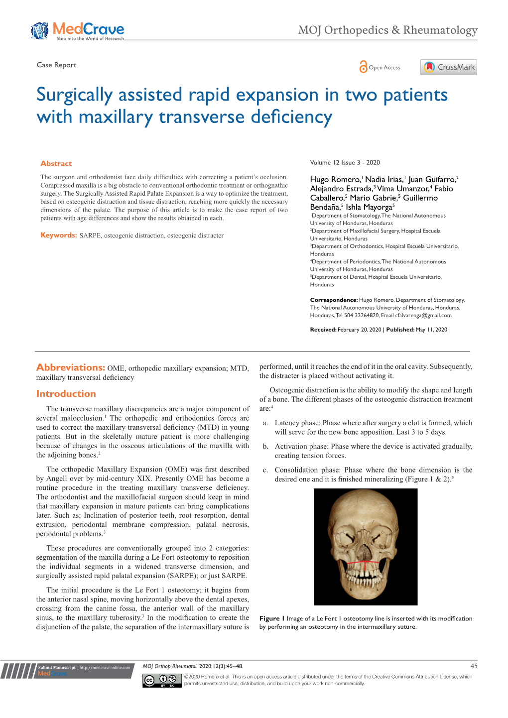 Surgically Assisted Rapid Expansion in Two Patients with Maxillary Transverse Deficiency