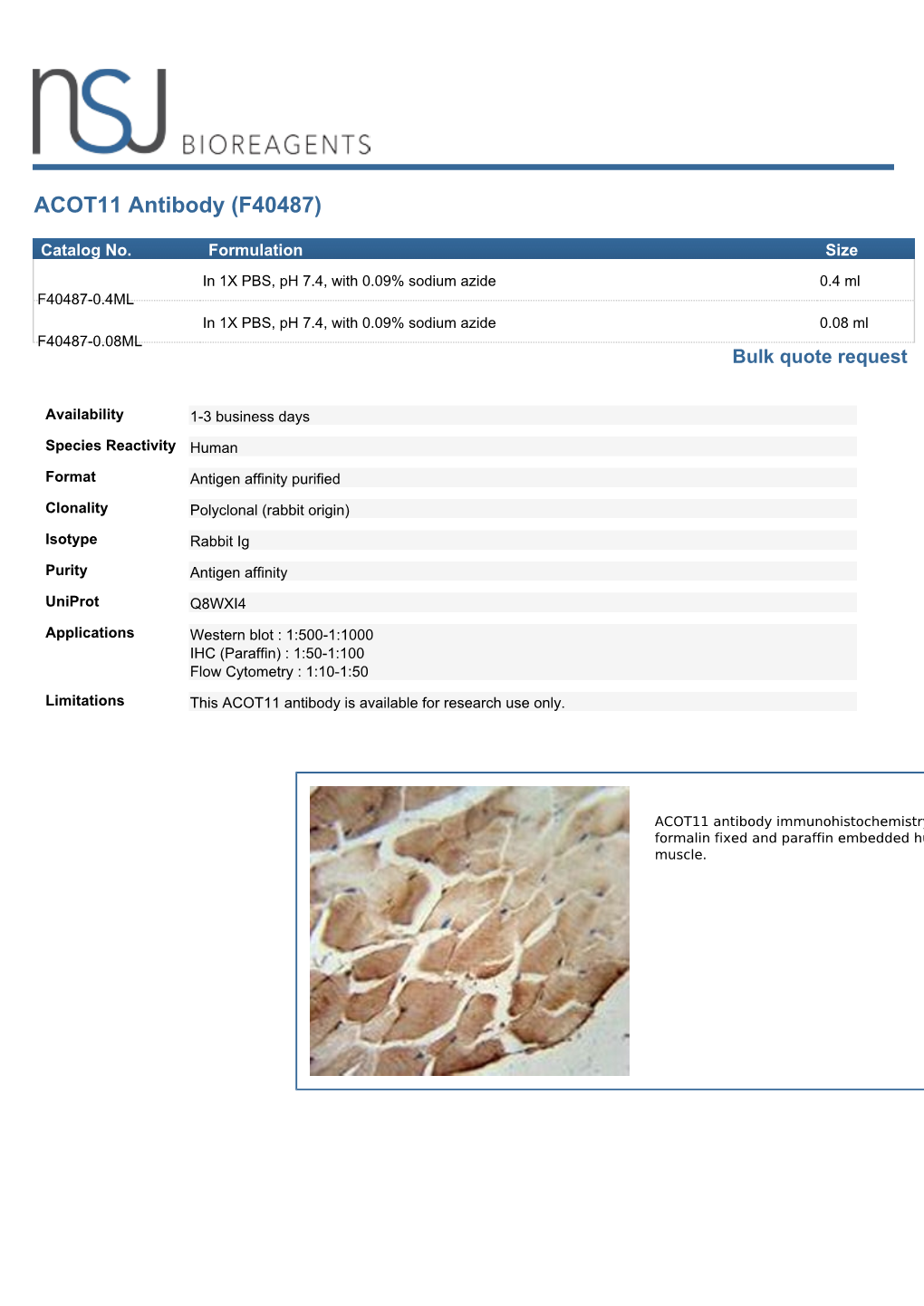 ACOT11 Antibody (F40487)