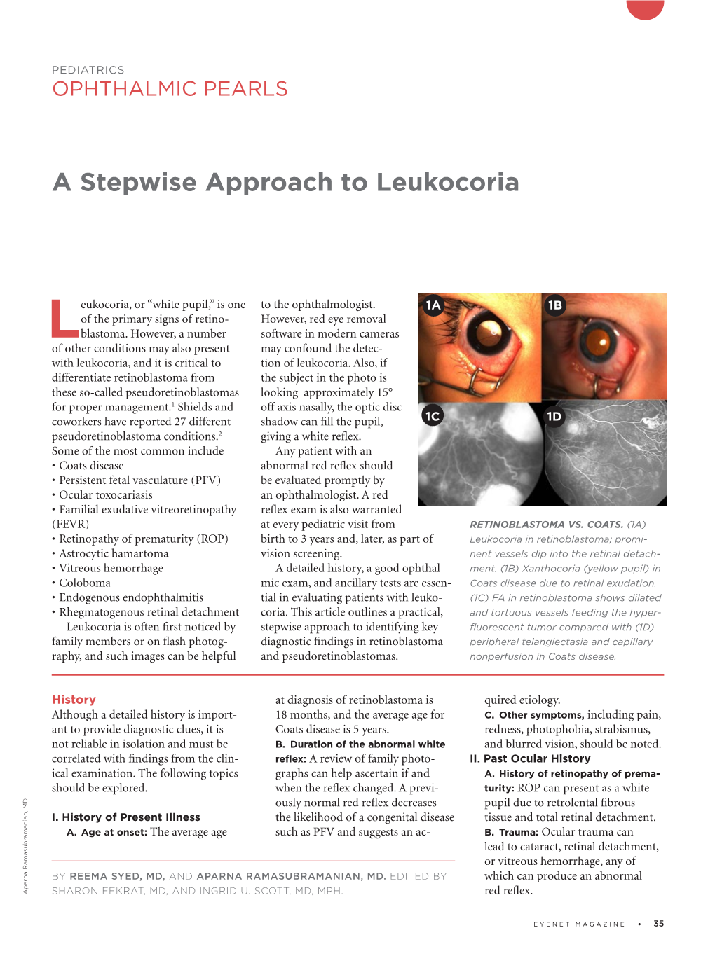 A Stepwise Approach to Leukocoria