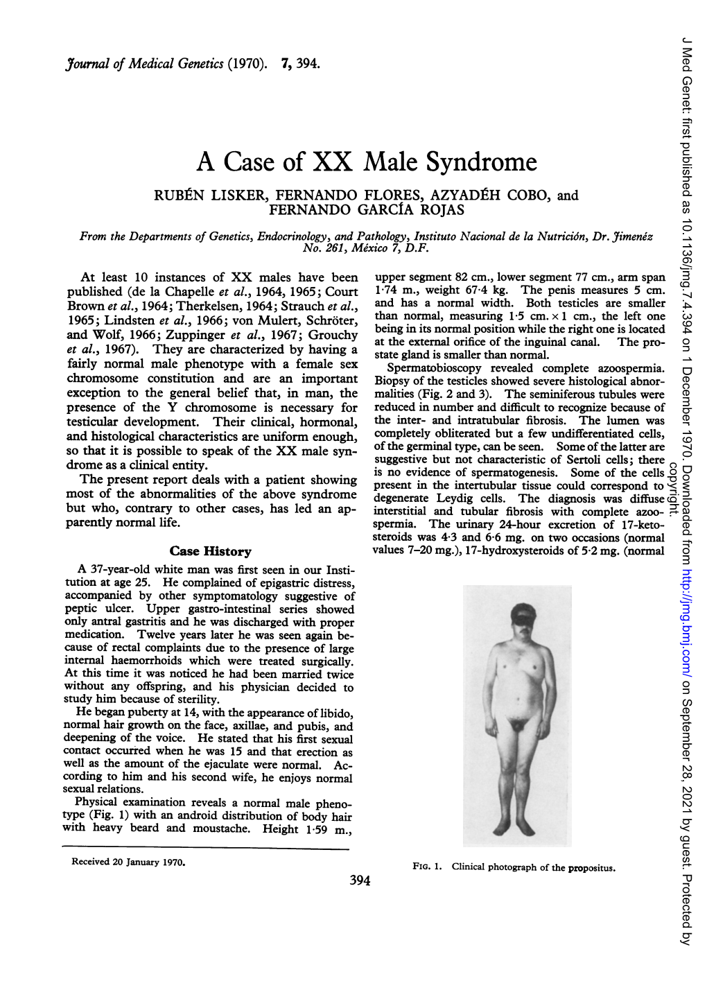 A Case of XX Male Syndrome
