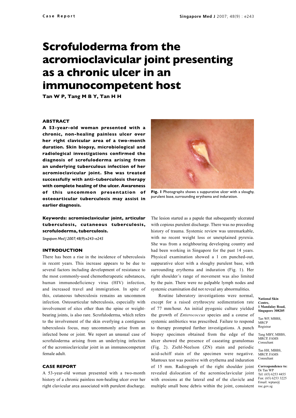 Scrofuloderma from the Acromioclavicular Joint Presenting As a Chronic Ulcer in an Immunocompetent Host Tan W P, Tang M B Y, Tan H H