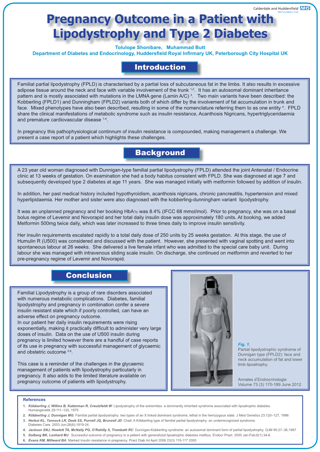 Pregnancy Outcome in a Patient with Lipodystrophy and Type 2 Diabetes