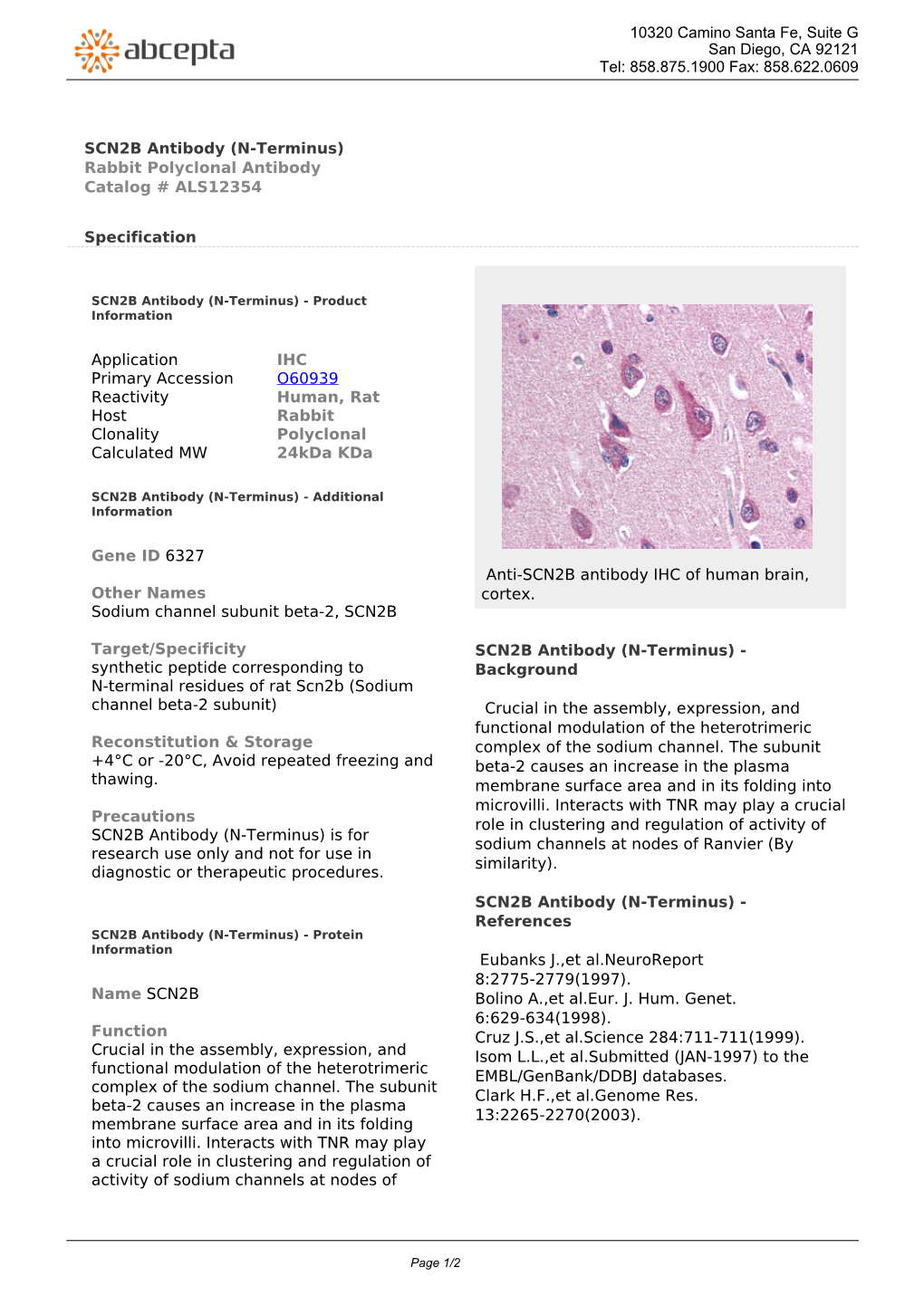 SCN2B Antibody (N-Terminus) Rabbit Polyclonal Antibody Catalog # ALS12354