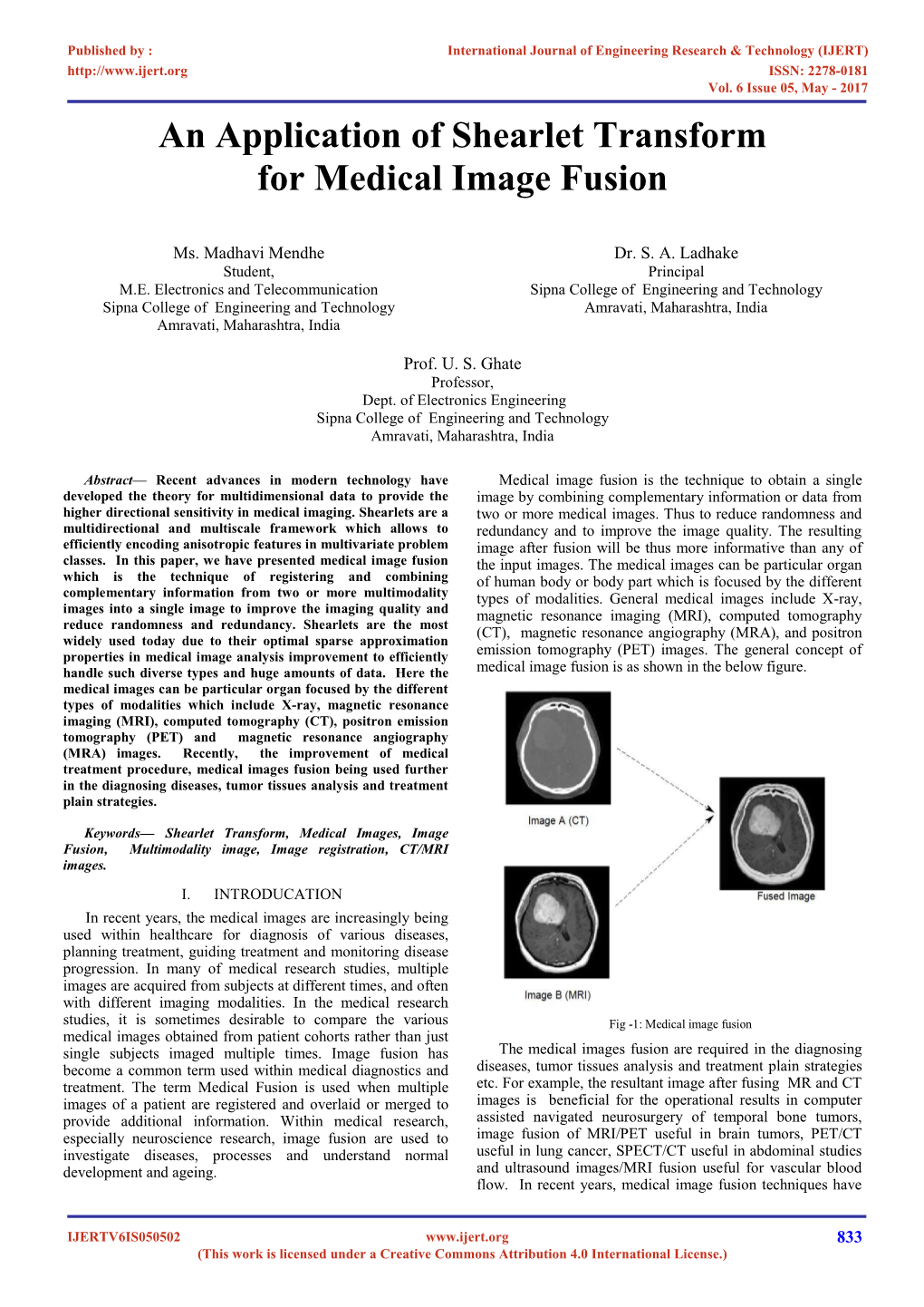 An Application of Shearlet Transform for Medical Image Fusion