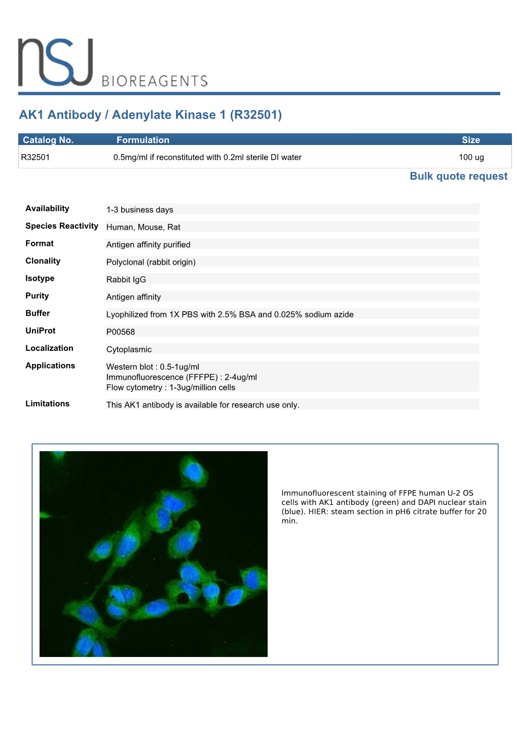 AK1 Antibody / Adenylate Kinase 1 (R32501)