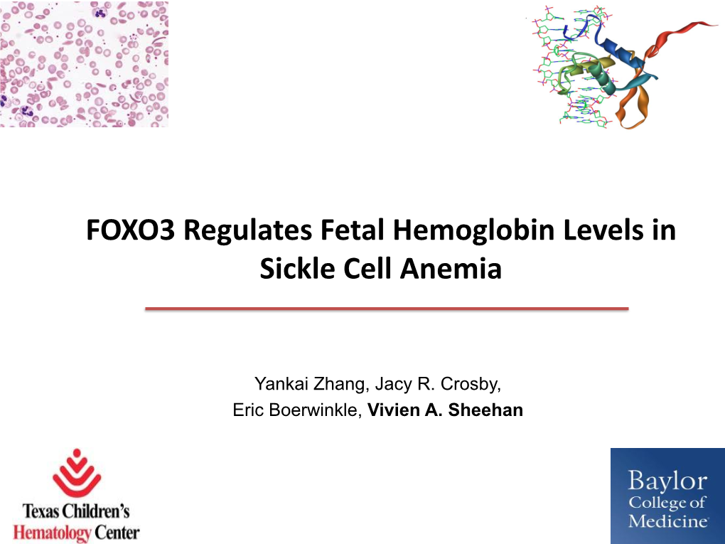 FOXO3 Regulates Fetal Hemoglobin Levels in Sickle Cell Anemia