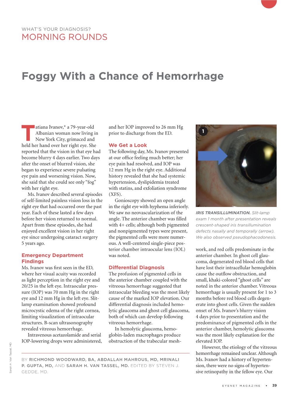 Foggy with a Chance of Hemorrhage