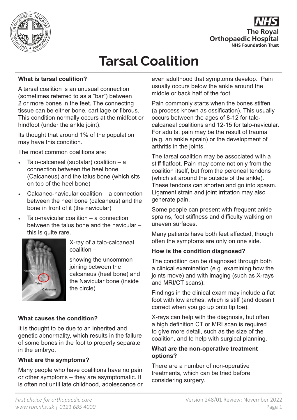 Tarsal Coalition