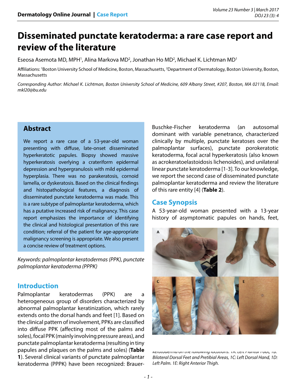 Disseminated Punctate Keratoderma: a Rare Case Report and Review of the Literature Eseosa Asemota MD, MPH1, Alina Markova MD2, Jonathan Ho MD2, Michael K