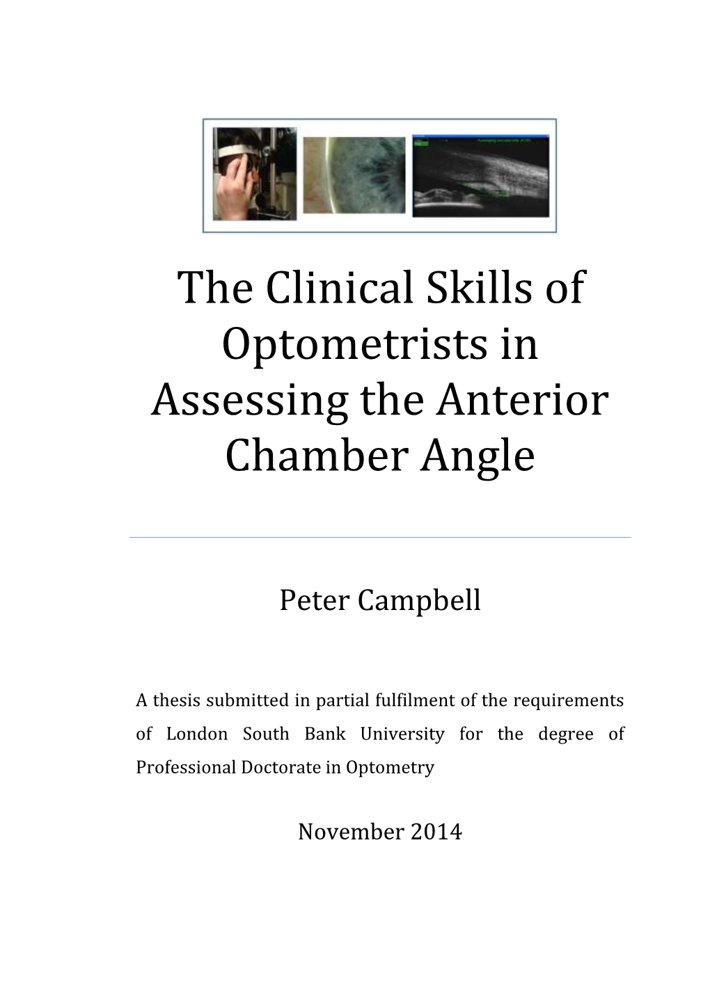 The Clinical Skills of Optometrists in Assessing the Anterior Chamber Angle