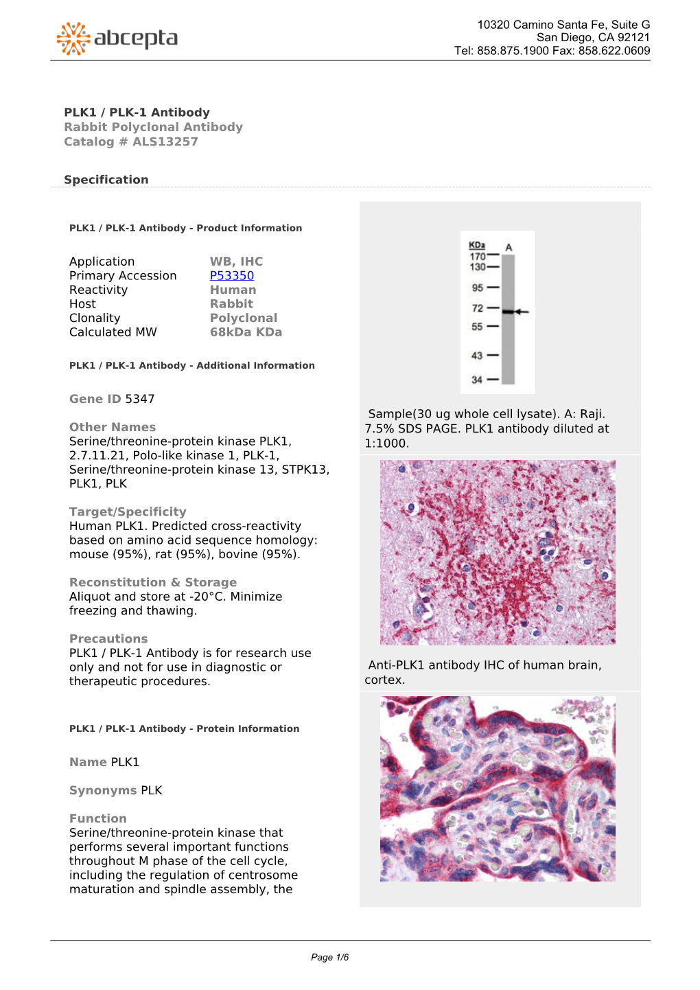PLK1 / PLK-1 Antibody Rabbit Polyclonal Antibody Catalog # ALS13257