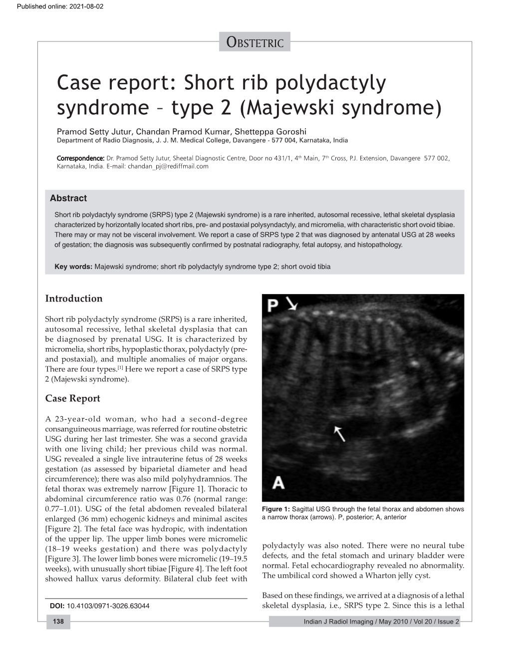 Short Rib Polydactyly Syndrome – Type 2 (Majewski Syndrome) Pramod Setty Jutur, Chandan Pramod Kumar, Shetteppa Goroshi Department of Radio Diagnosis, J