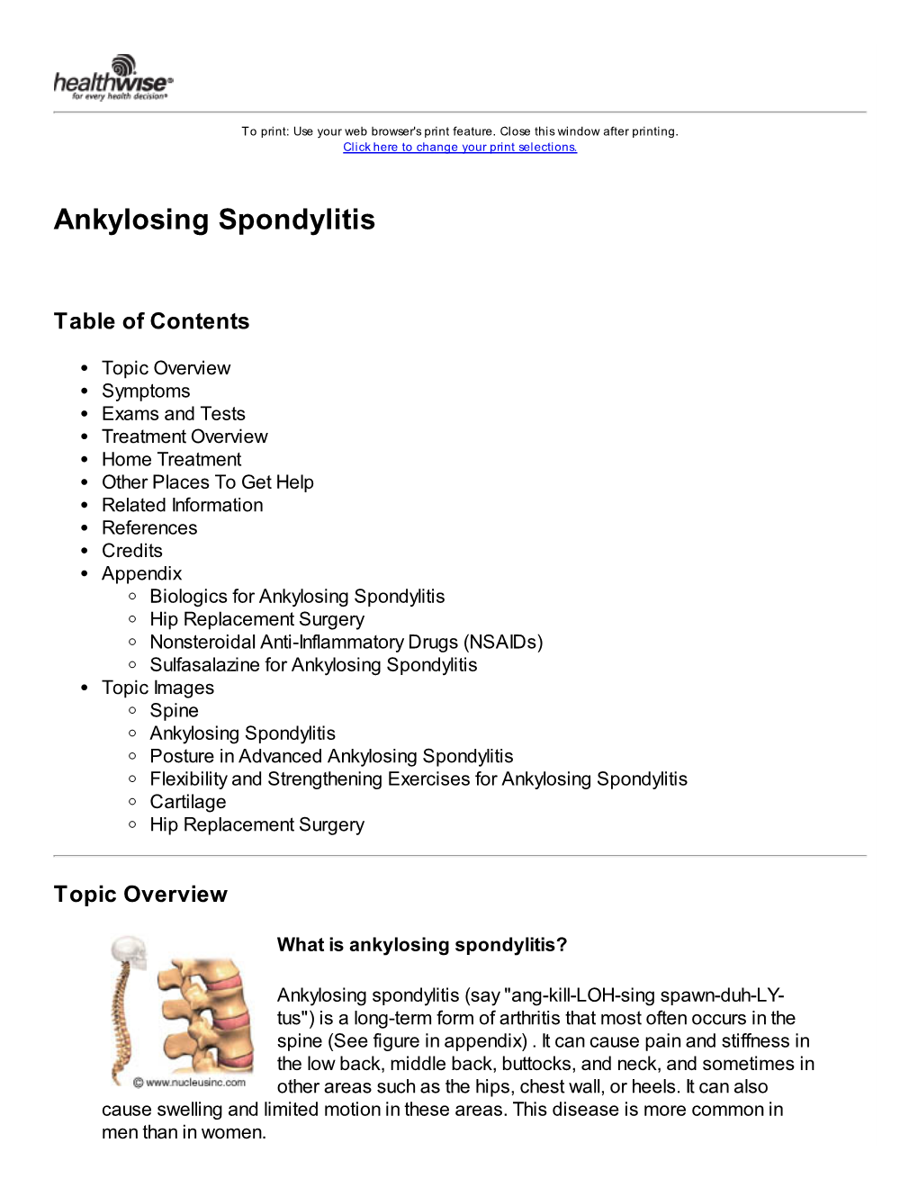 Ankylosing Spondylitis