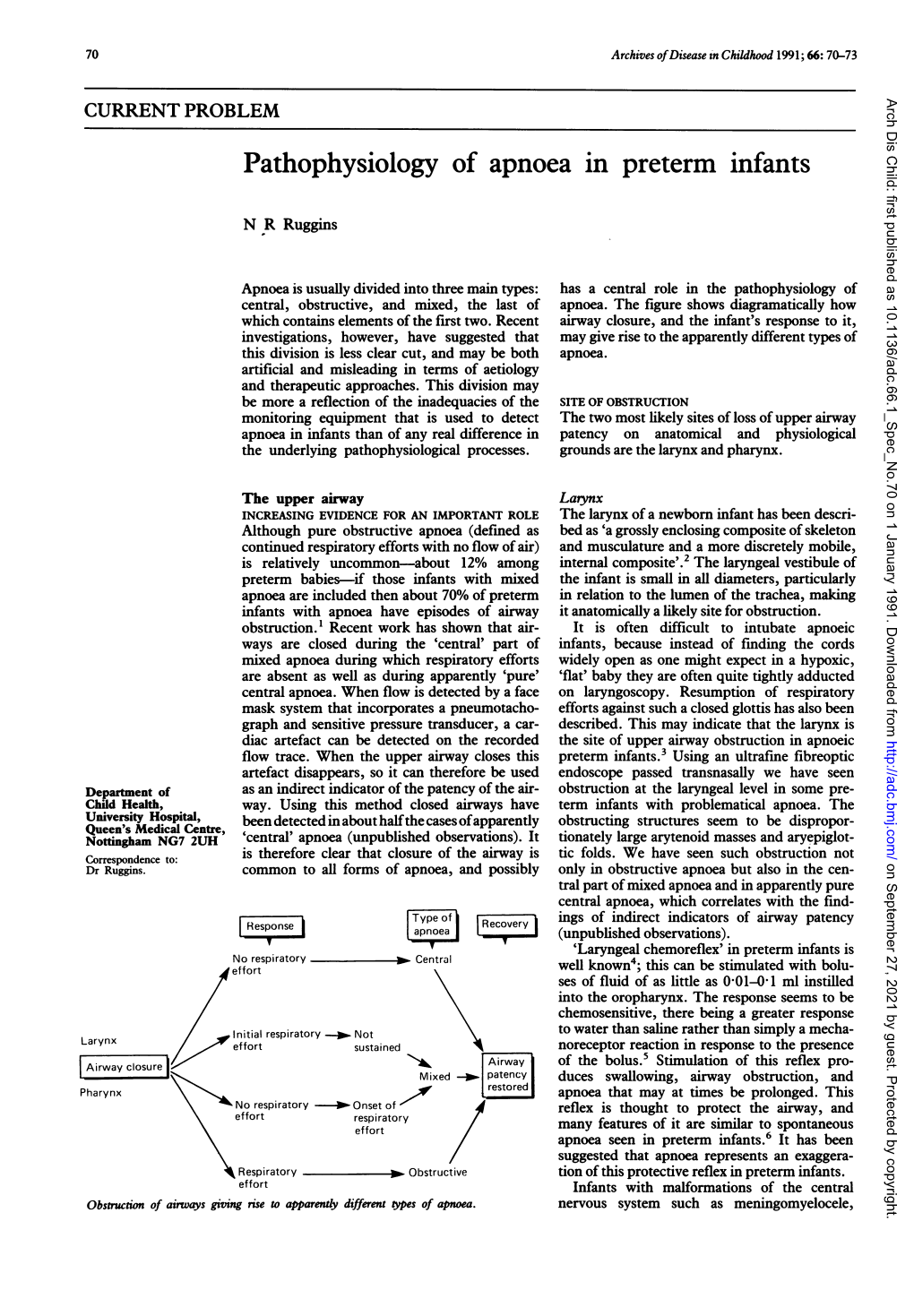 Pathophysiology of Apnoea in Preterm Infants