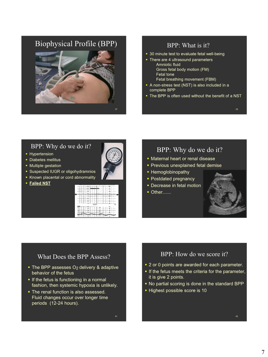 Biophysical Profile (BPP) BPP: What Is It?