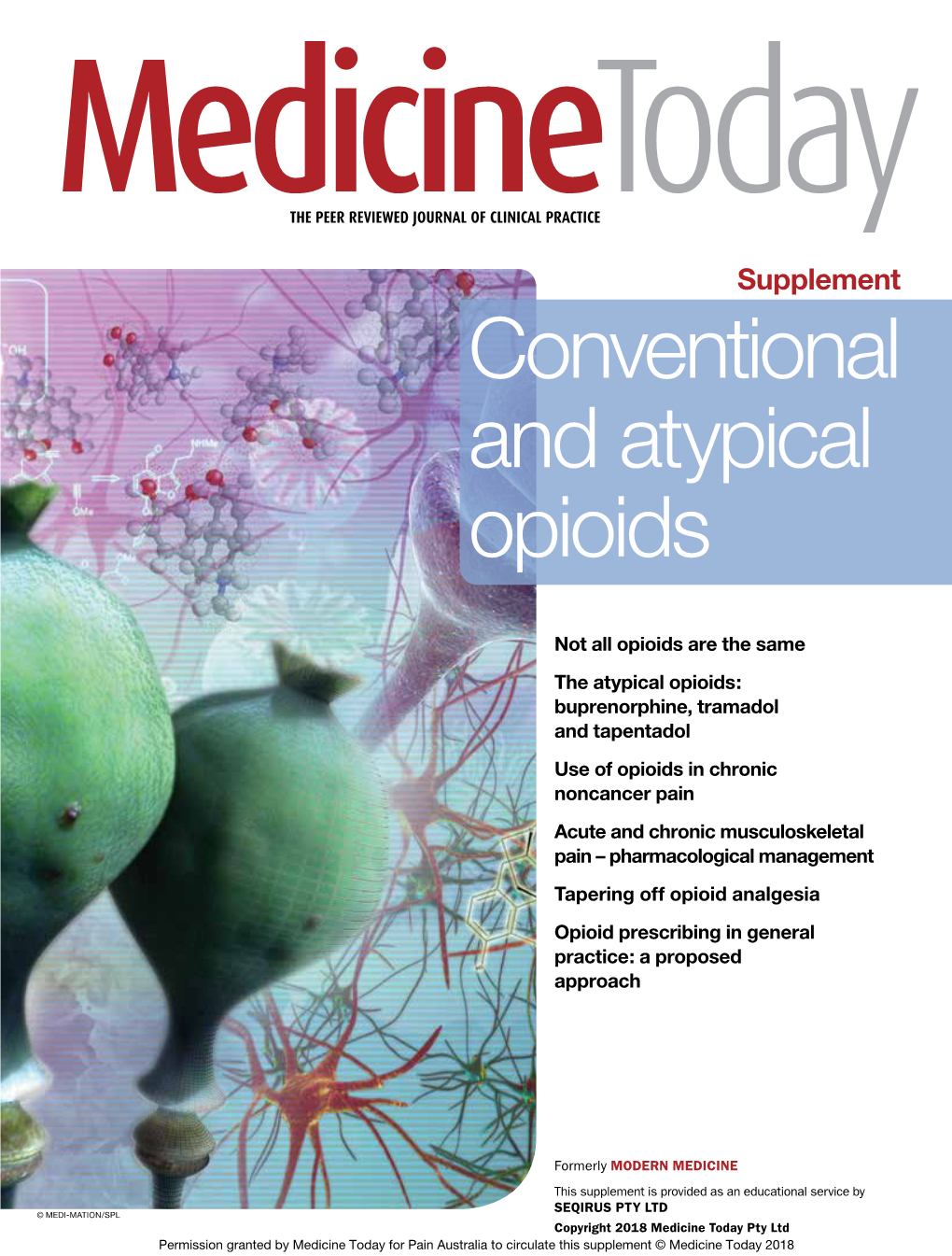 Conventional and Atypical Opioids