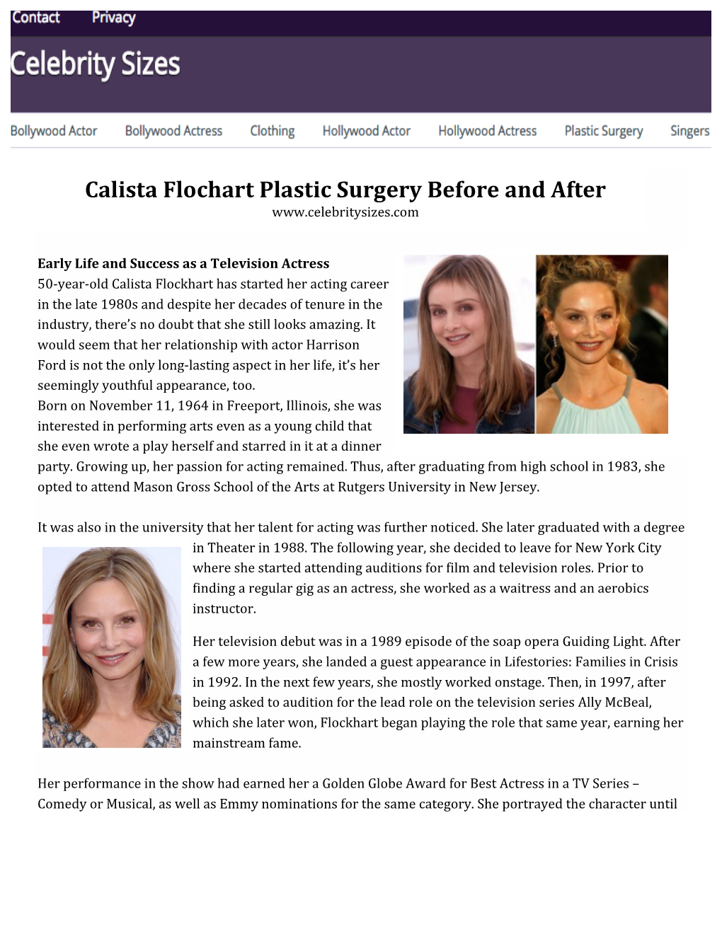 Calista Flochart Plastic Surgery Before and After