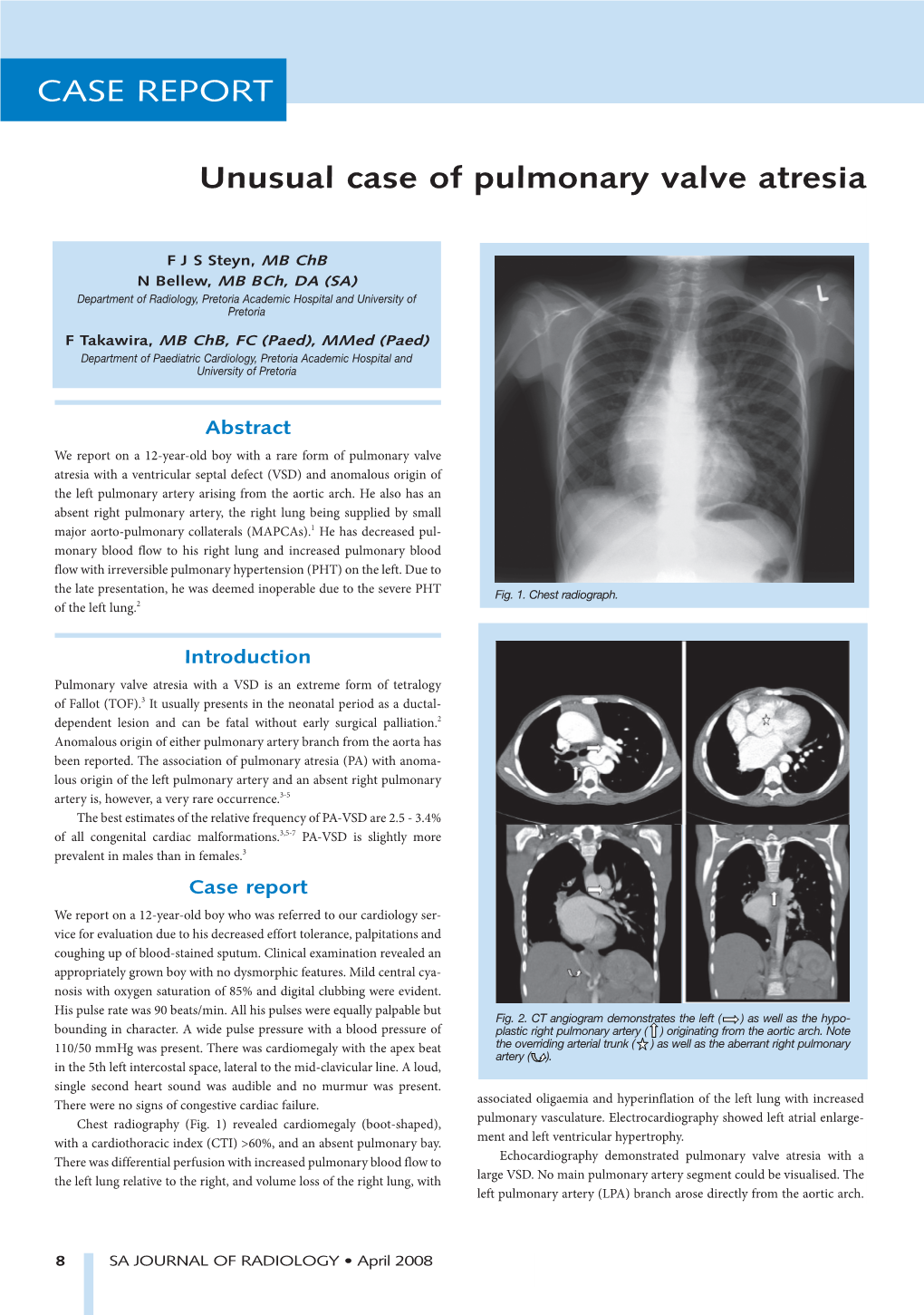 CASE REPORT CASE Unusual Case of Pulmonary Valve Atresia