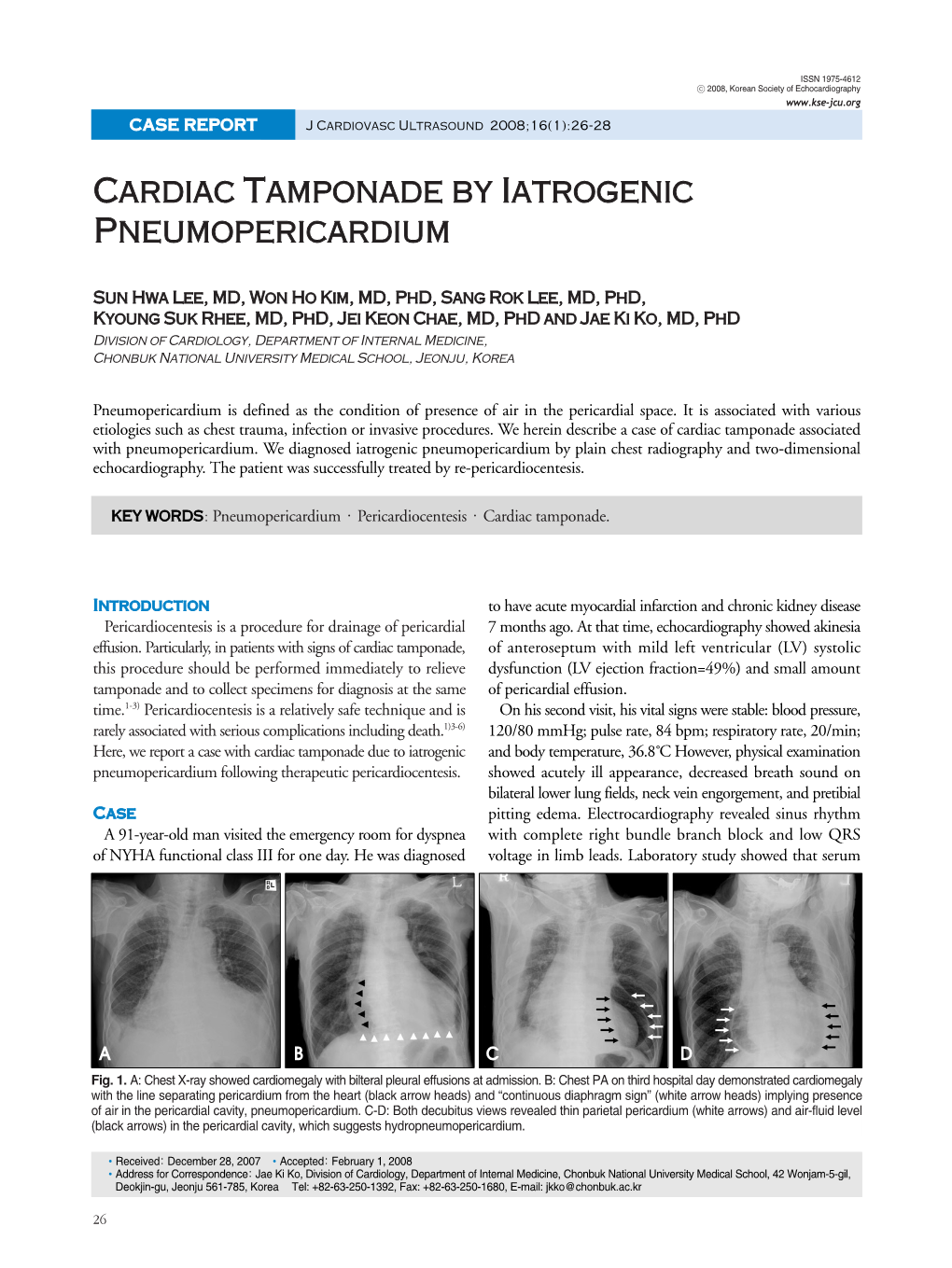 Cardiac Tamponade by Iatrogenic Pneumopericardium