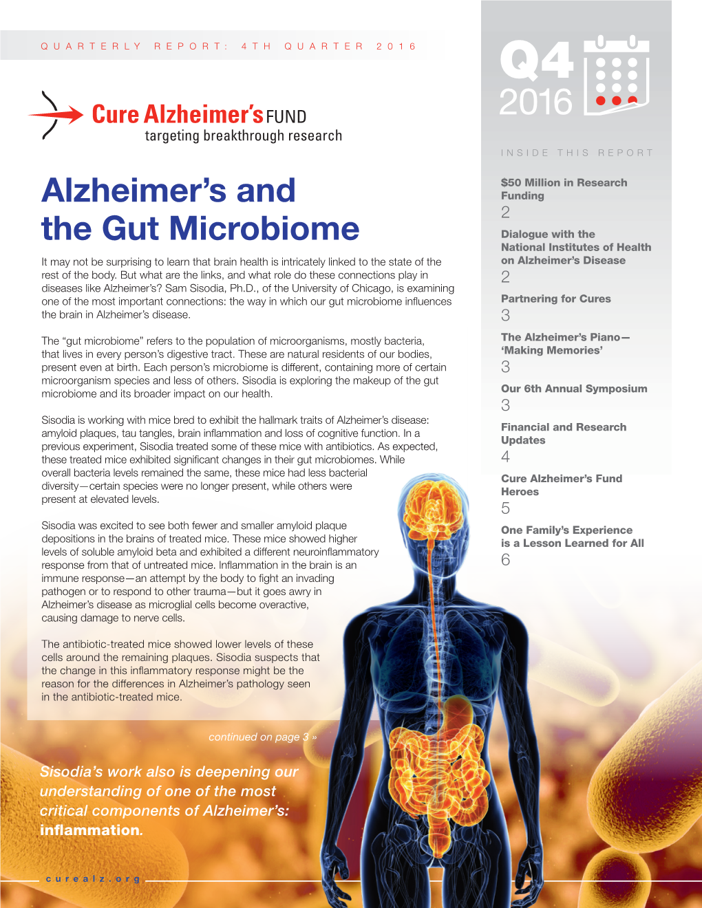 Alzheimer's and the Gut Microbiome