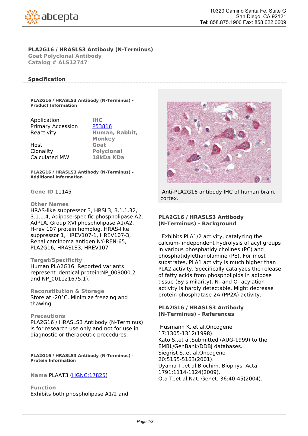PLA2G16 / HRASLS3 Antibody (N-Terminus) Goat Polyclonal Antibody Catalog # ALS12747
