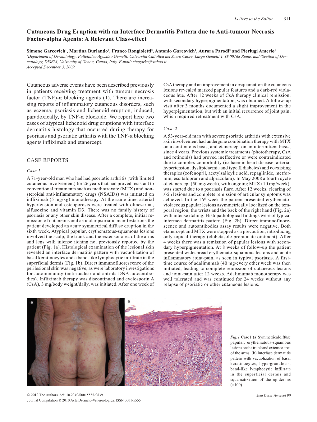 Cutaneous Drug Eruption with an Interface Dermatitis Pattern Due to Anti-Tumour Necrosis Factor-Alpha Agents: a Relevant Class-Effect