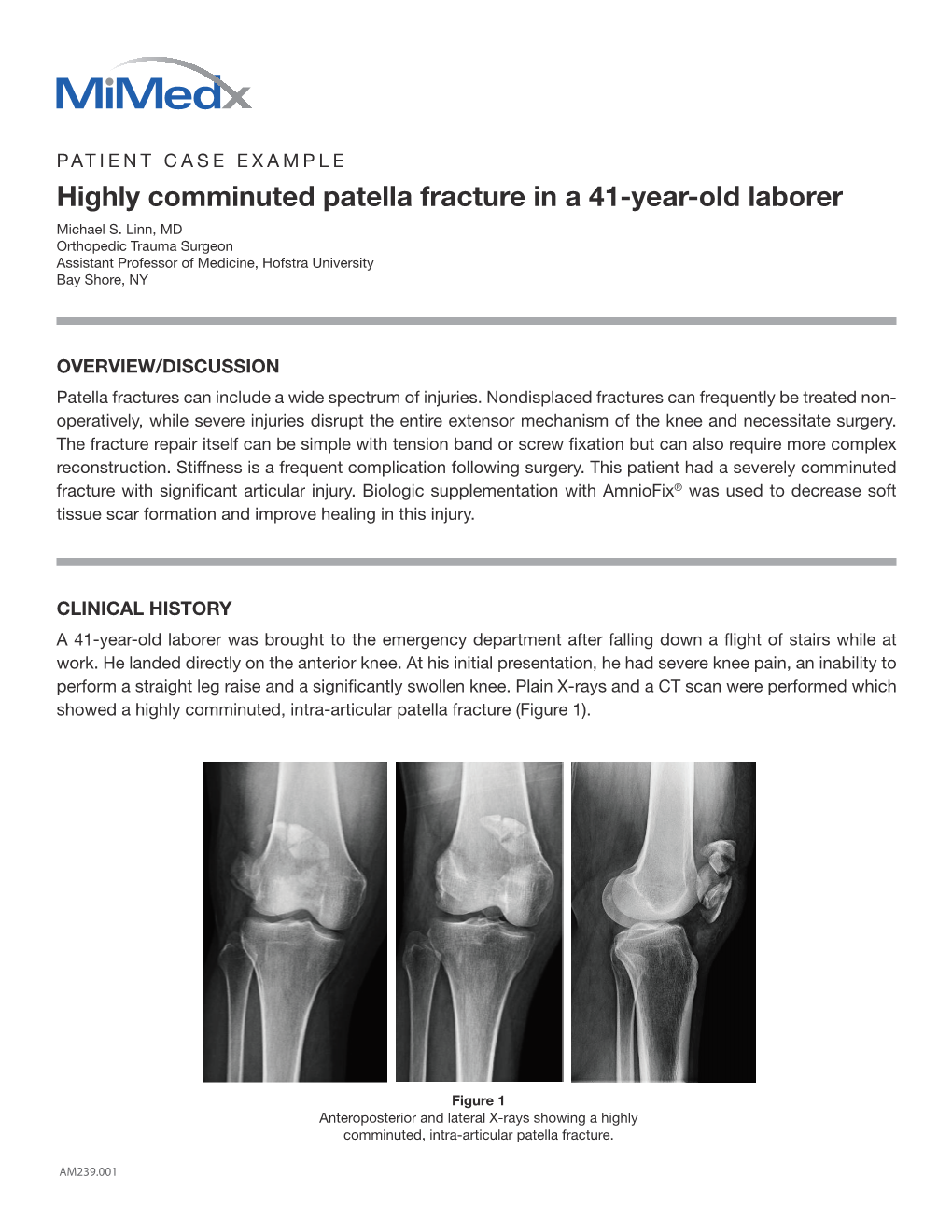 Highly Comminuted Patella Fracture in a 41-Year-Old Laborer Michael S