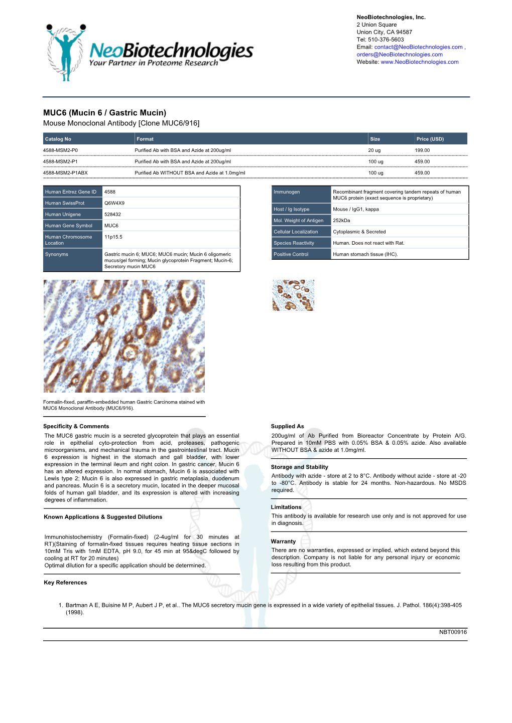 MUC6 (Mucin 6 / Gastric Mucin) Mouse Monoclonal Antibody [Clone MUC6/916]