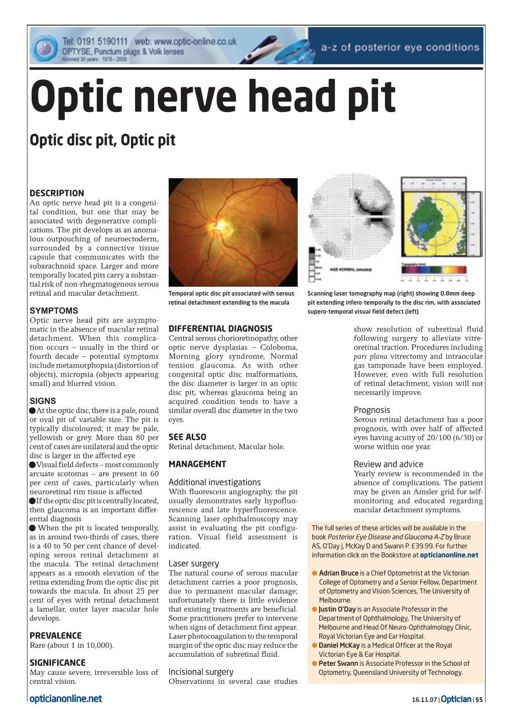 Optic Nerve Head Pit Optic Disc Pit, Optic Pit