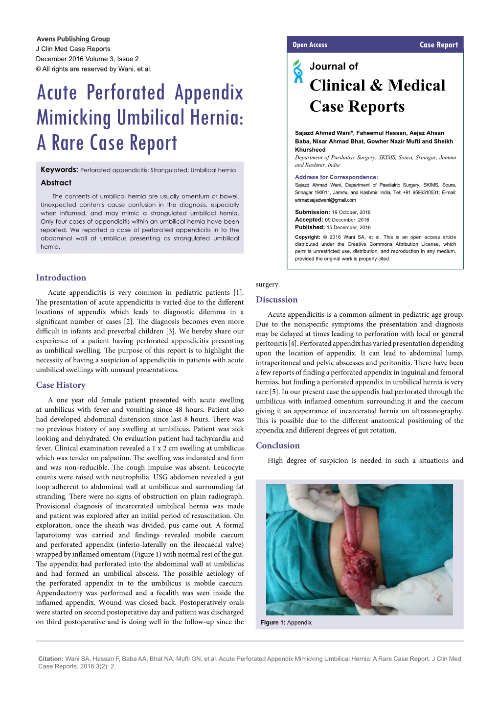 Acute Perforated Appendix Mimicking Umbilical Hernia: a Rare Case Report