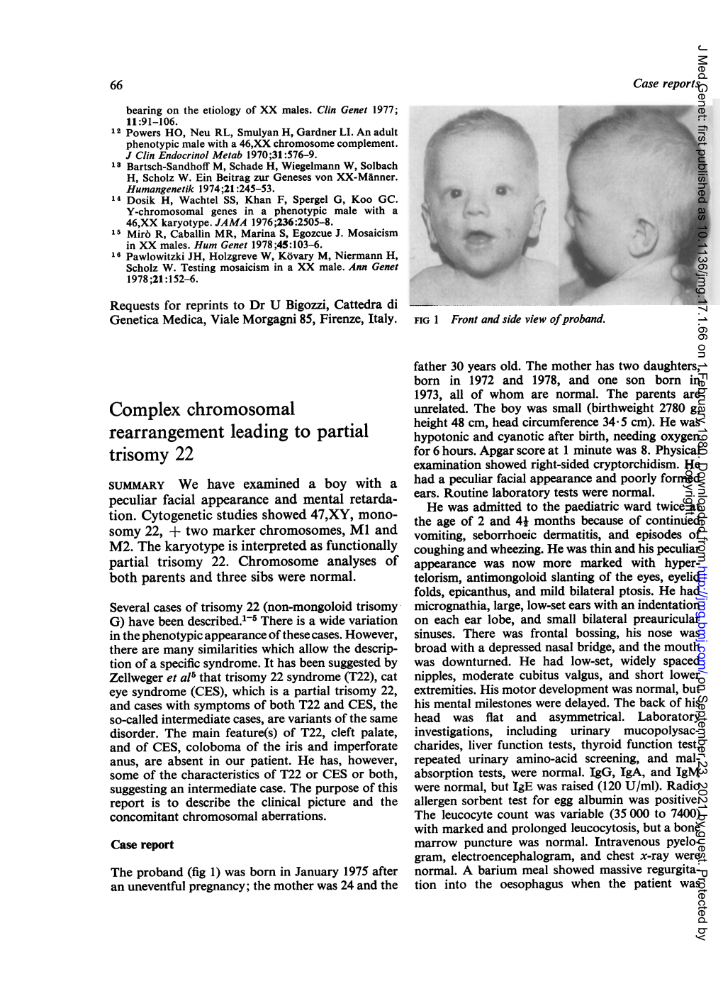 Complex Chromosomal Trisomy 22