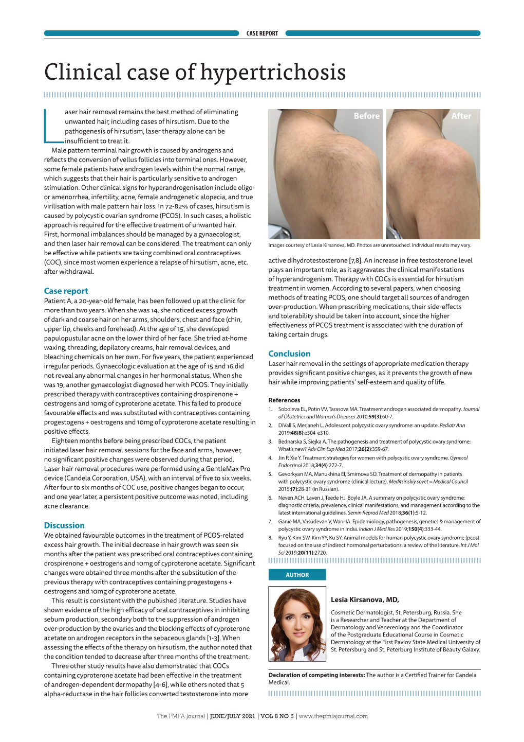 Clinical Case of Hypertrichosis