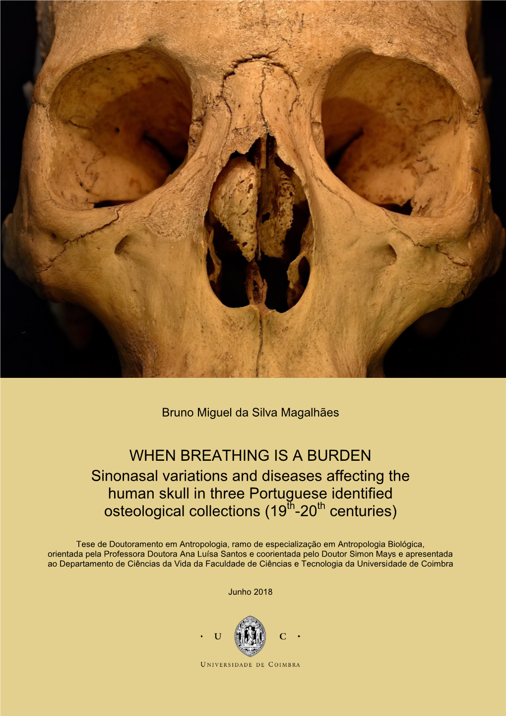 WHEN BREATHING IS a BURDEN Sinonasal Variations and Diseases Affecting the Human Skull in Three Portuguese Identified Osteological Collections (19Th-20Th Centuries)