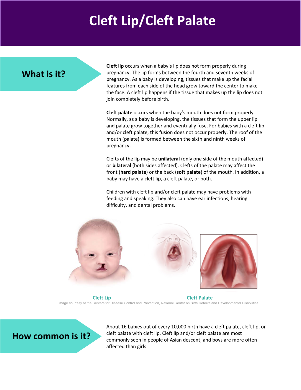 Cleft Lip and Cleft Palate for Most Babies Is Unknown