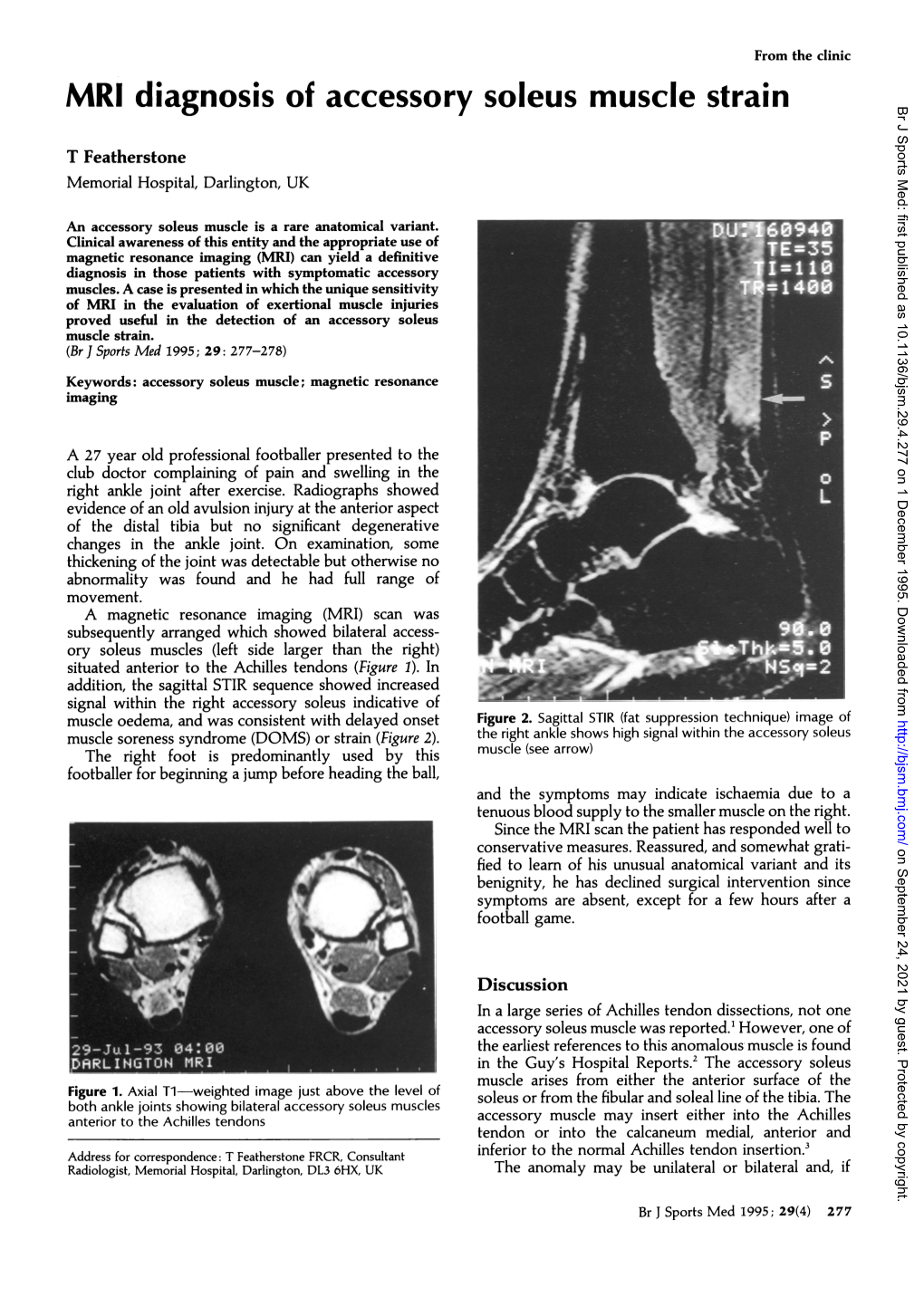 MRI Diagnosis of Accessory Soleus Muscle Strain Br J Sports Med: First Published As 10.1136/Bjsm.29.4.277 on 1 December 1995