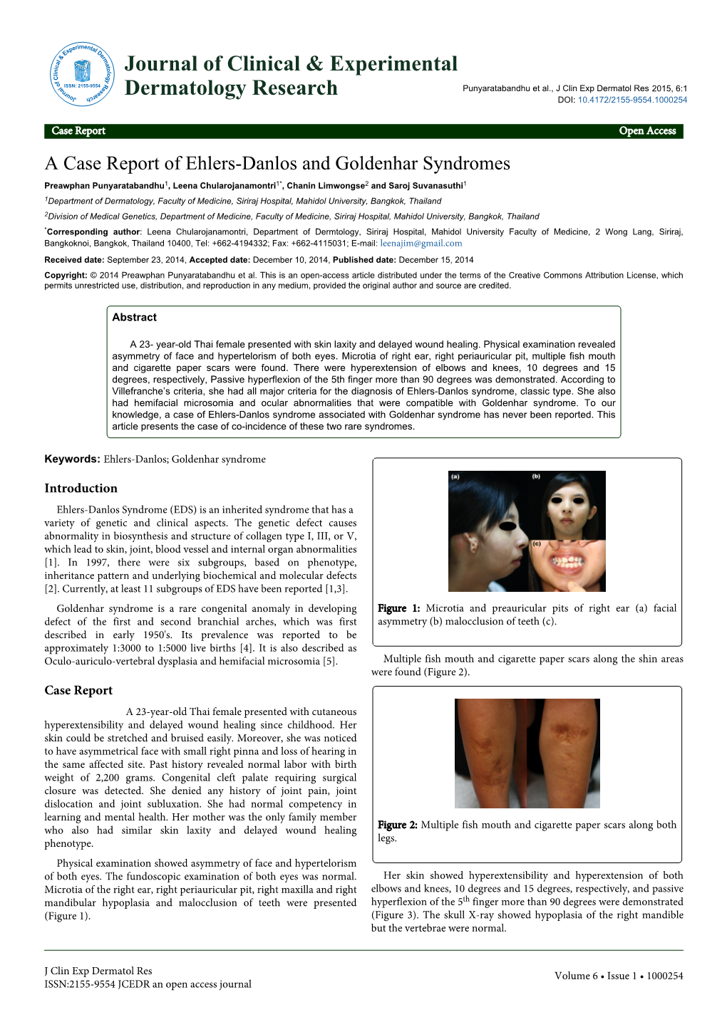 A Case Report of Ehlers-Danlos and Goldenhar Syndromes