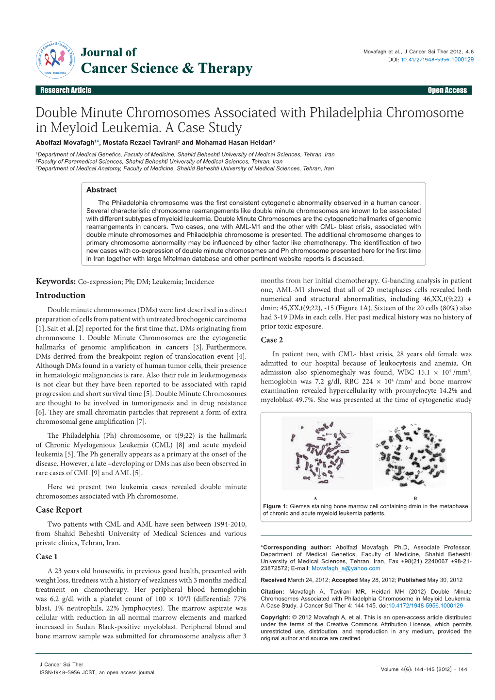 Double Minute Chromosomes Associated with Philadelphia Chromosome in Meyloid Leukemia
