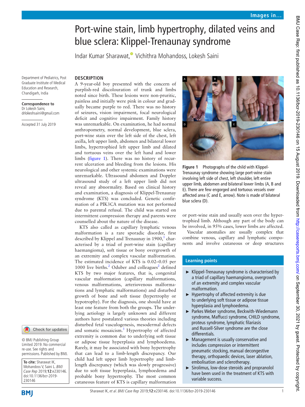 Port-Wine Stain, Limb Hypertrophy, Dilated Veins and Blue Sclera: Klippel-Trenaunay Syndrome Indar Kumar Sharawat, Vichithra Mohandoss, Lokesh Saini