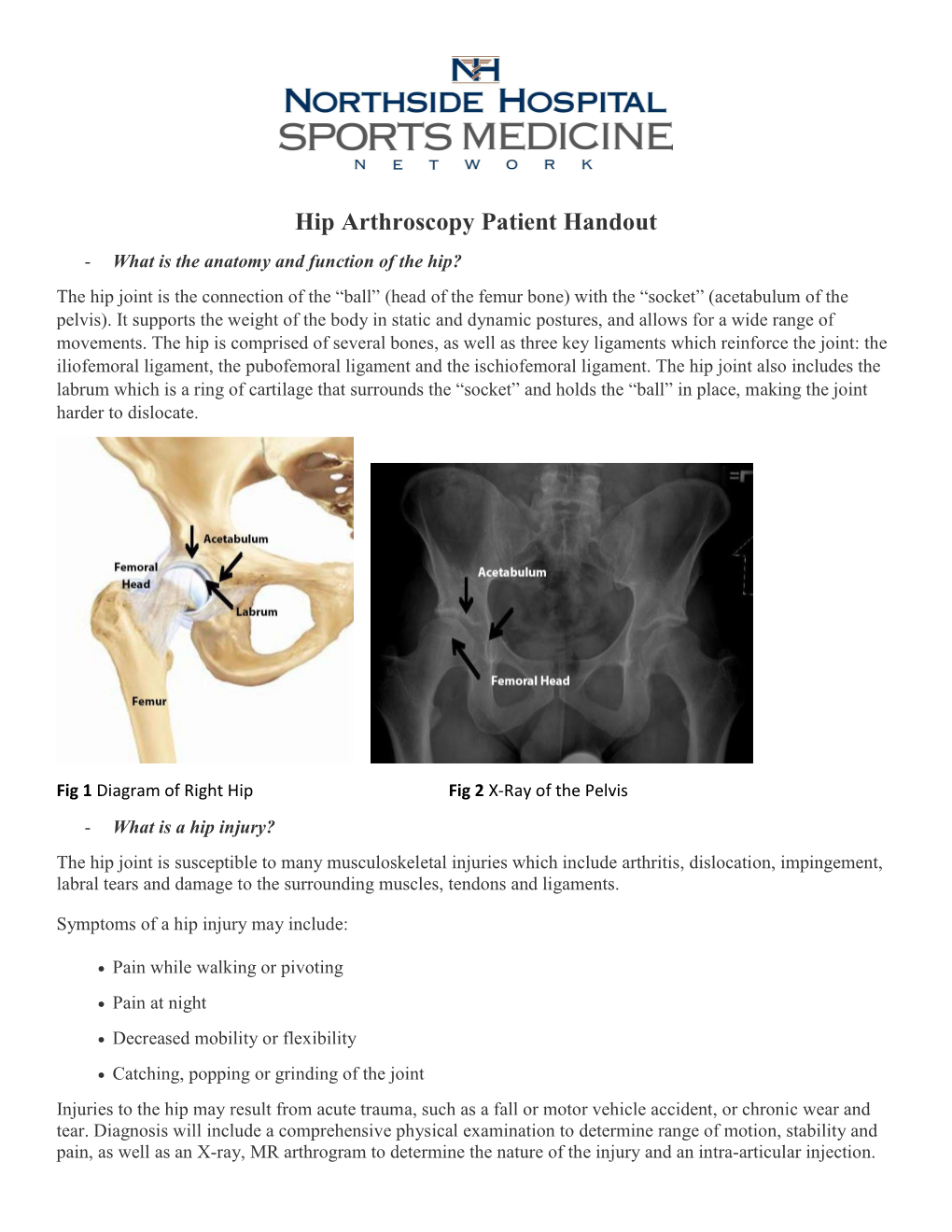 Hip Arthroscopy Patient Handout