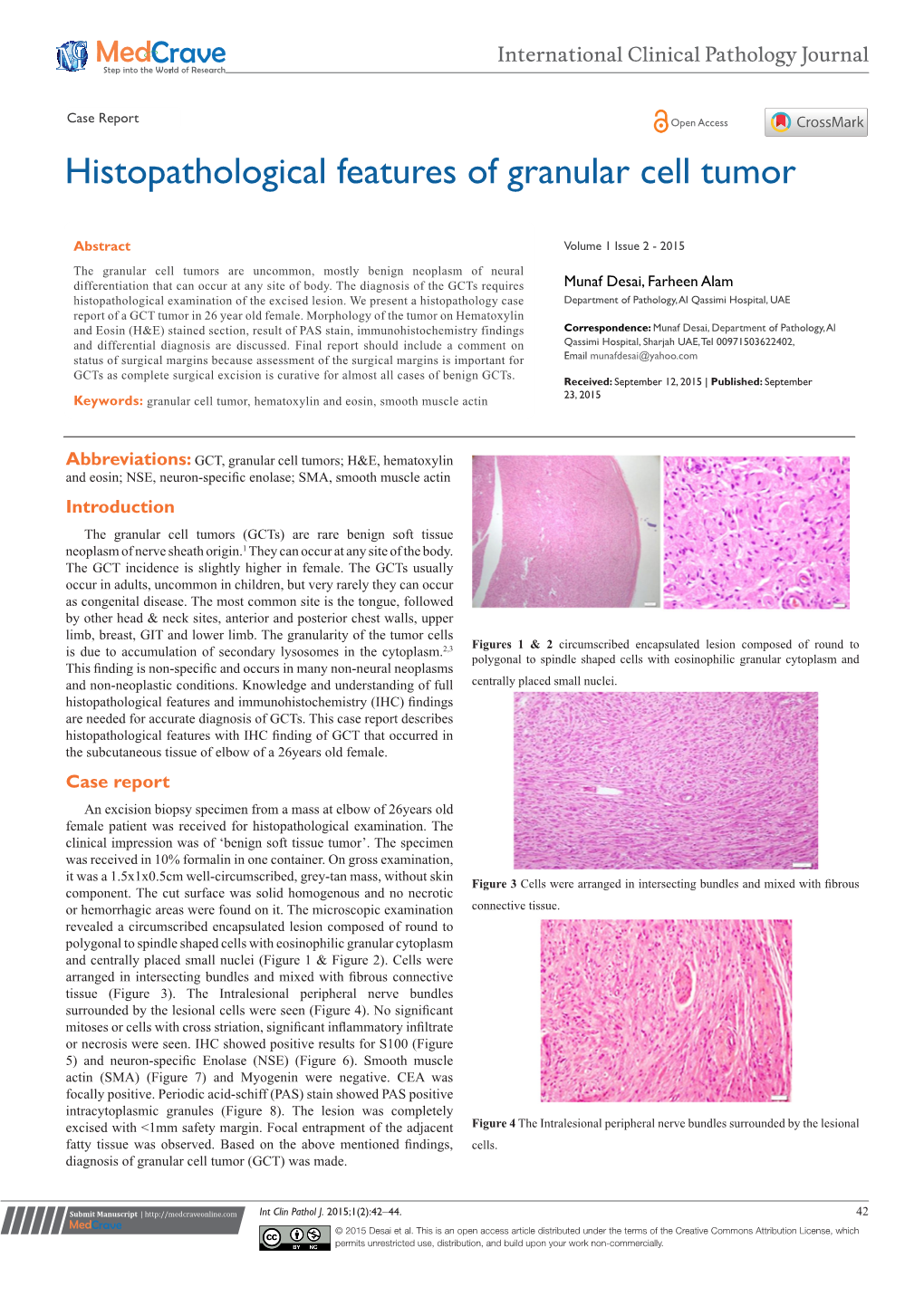 Histopathological Features of Granular Cell Tumor