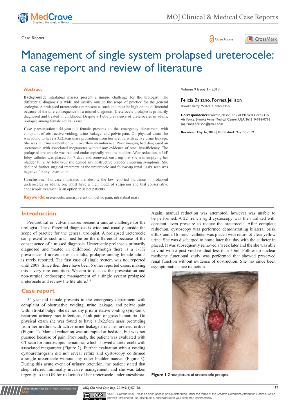 Management of Single System Prolapsed Ureterocele: a Case Report and Review of Literature