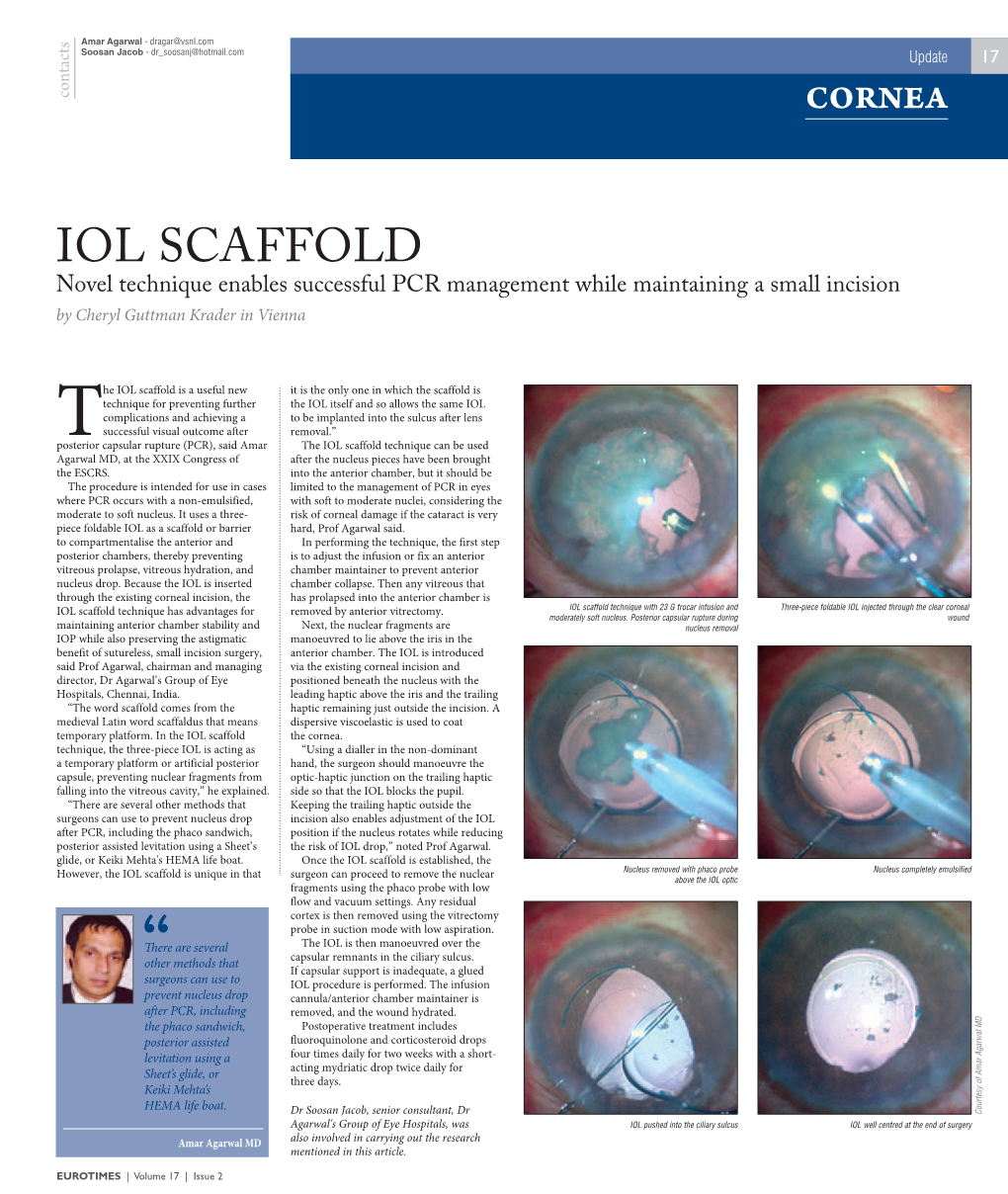 IOL SCAFFOLD Novel Technique Enables Successful PCR Management While Maintaining a Small Incision by Cheryl Guttman Krader in Vienna