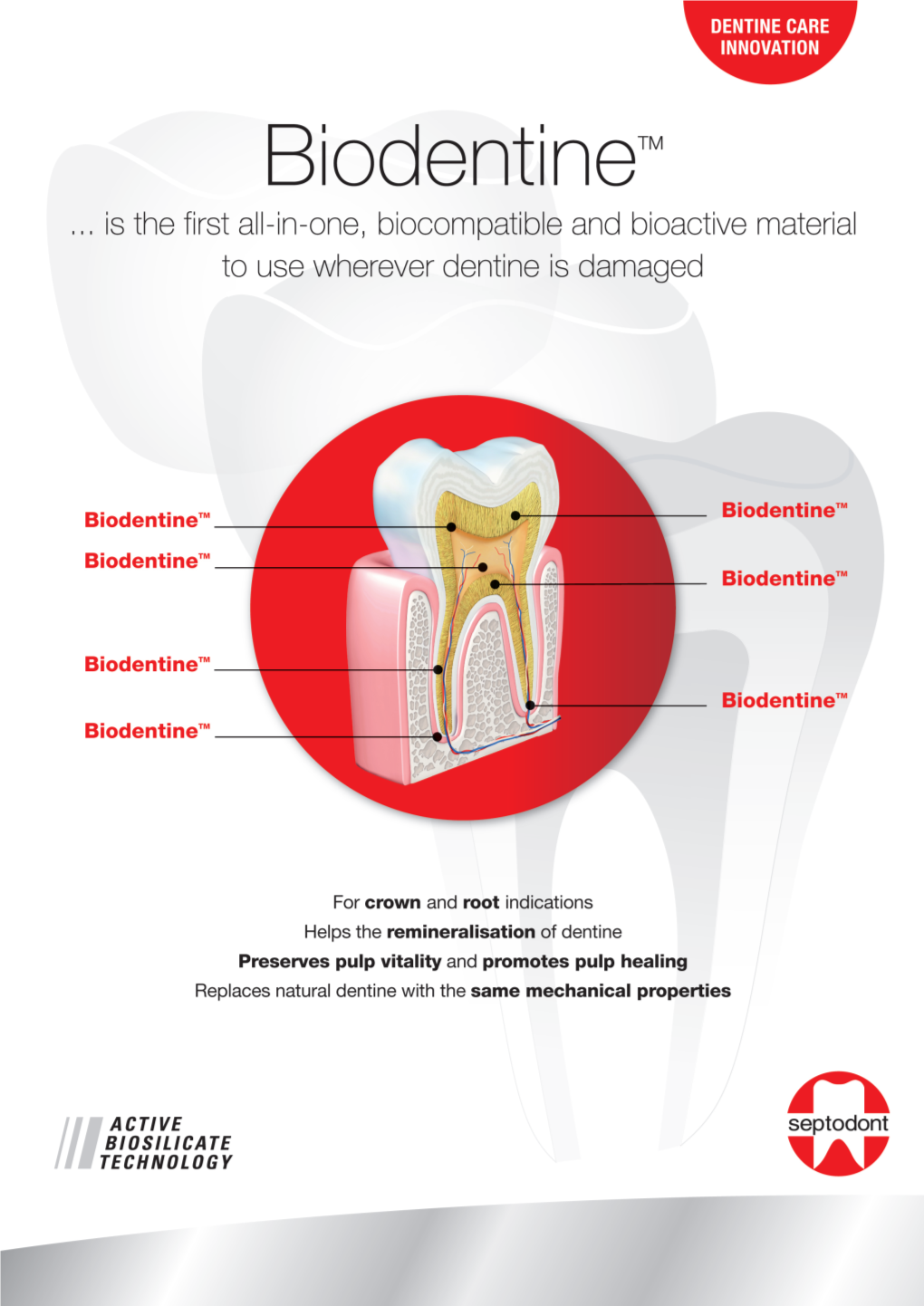 Wherever Dentine Is Damaged, You Can Use Biodentine