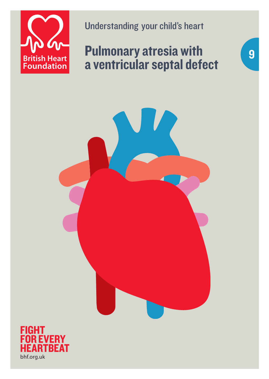 Pulmonary Atresia with a Ventricular Septal Defect